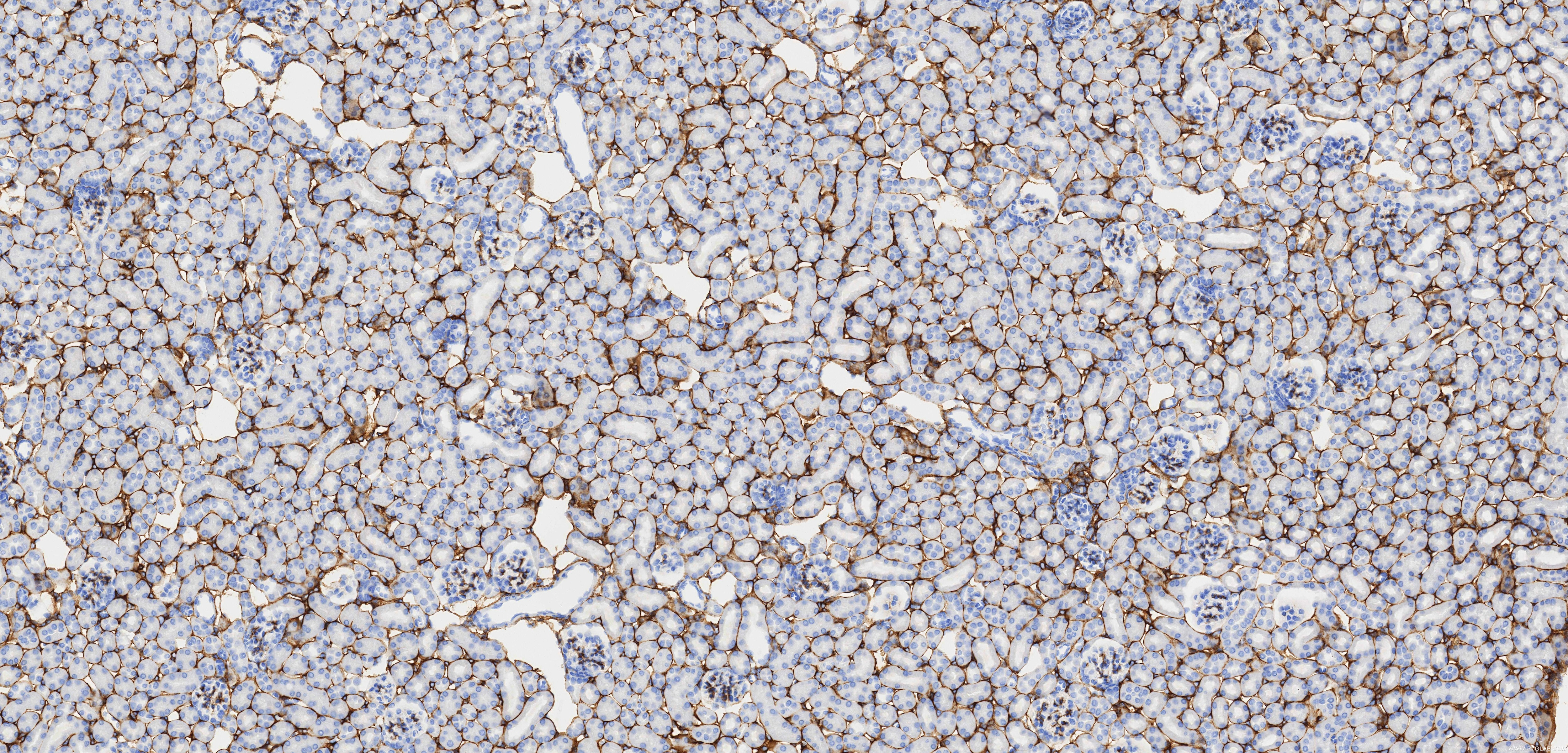 Immunohistochemistry (IHC) staining of mouse kidney tissue using COL6A1 Recombinant monoclonal antibody (85704-1-RR)