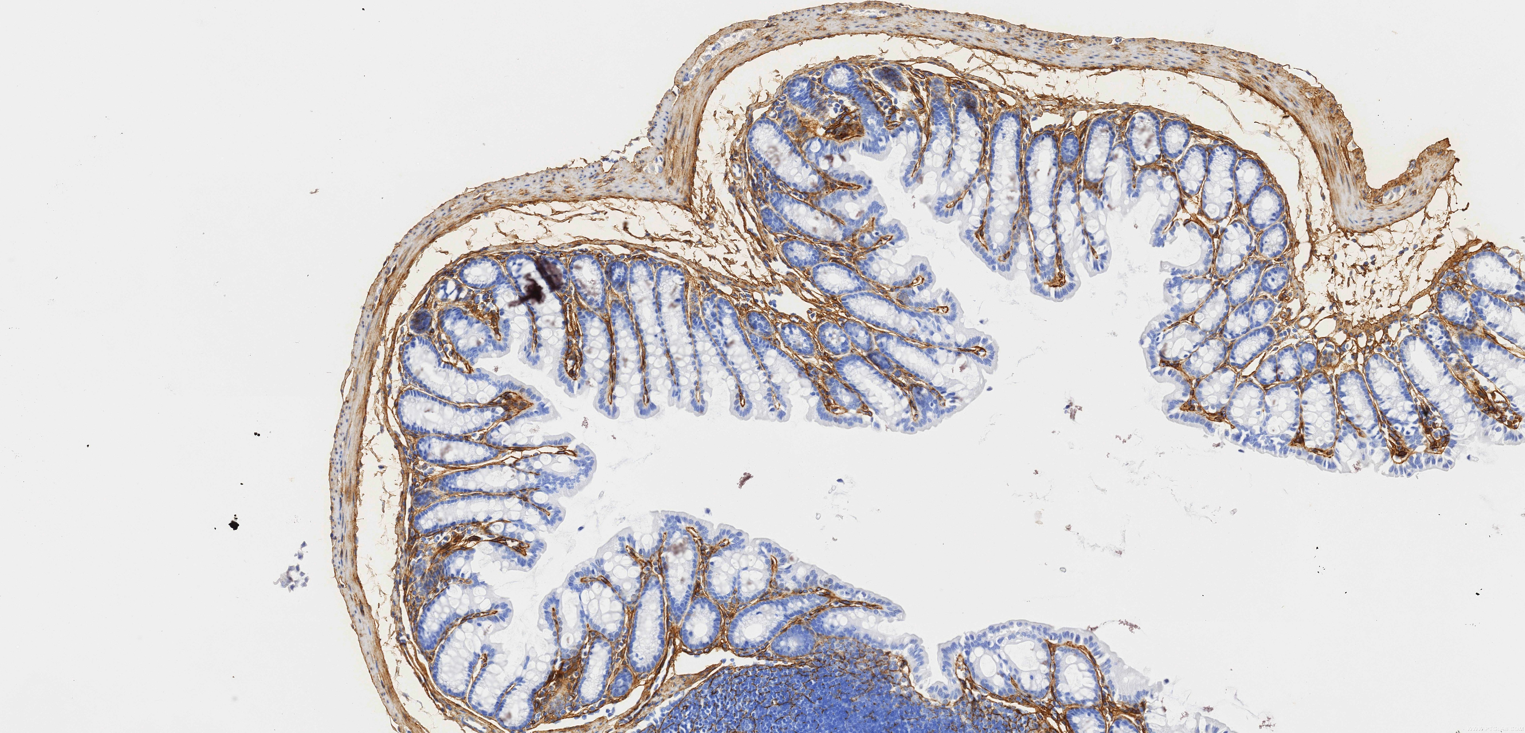 Immunohistochemistry (IHC) staining of mouse colon tissue using COL6A1 Recombinant monoclonal antibody (85704-1-RR)