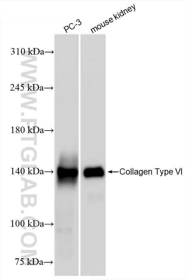 Western Blot (WB) analysis of various lysates using COL6A1 Recombinant antibody (85704-1-RR)