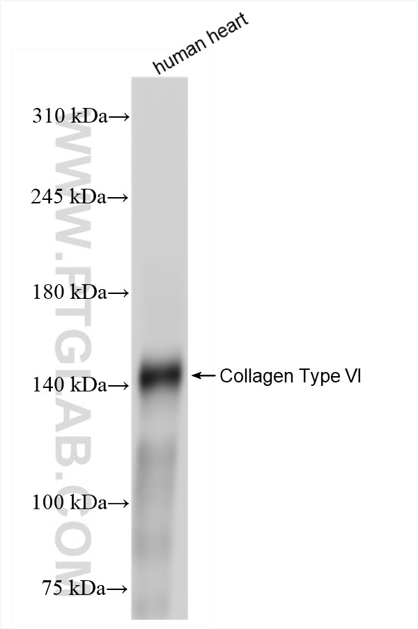 Western Blot (WB) analysis of human heart tissue using COL6A1 Recombinant antibody (85704-1-RR)
