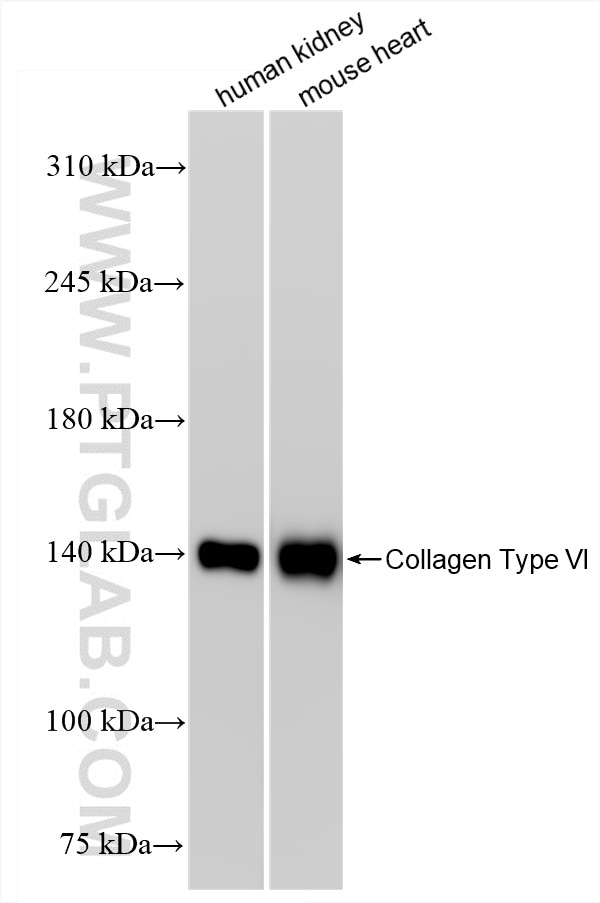 Western Blot (WB) analysis of various lysates using COL6A1 Recombinant antibody (85704-1-RR)