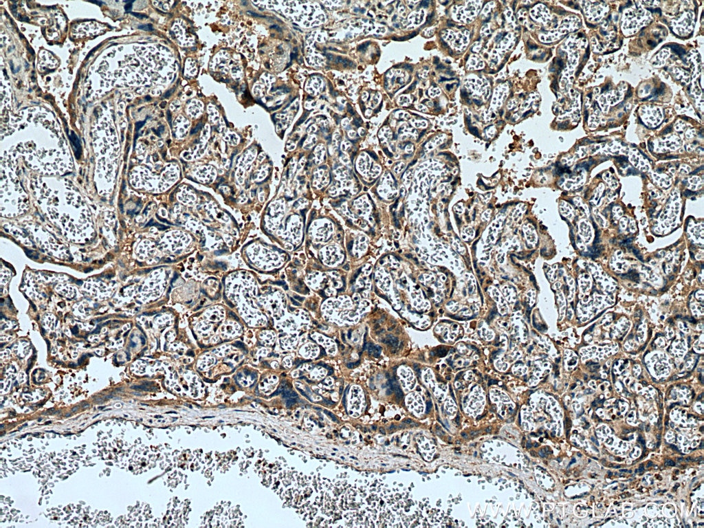 Immunohistochemistry (IHC) staining of human placenta tissue using Collagen Type XI Polyclonal antibody (21841-1-AP)