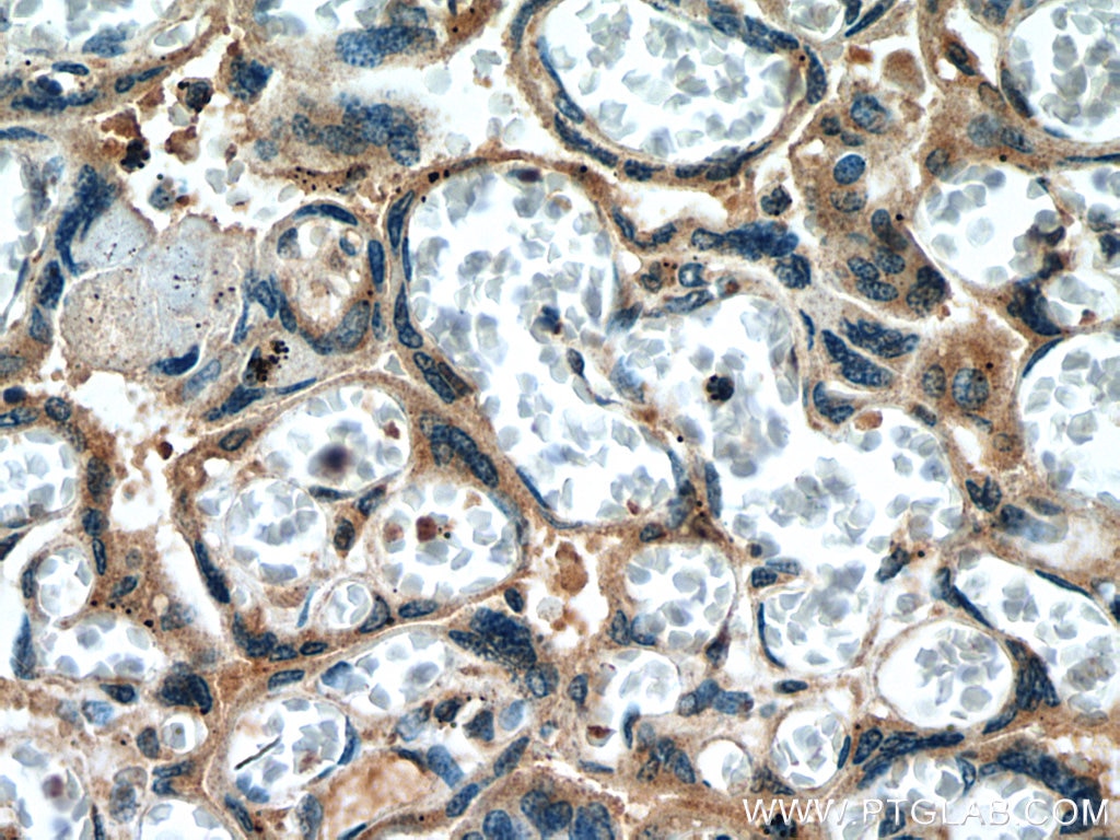 Immunohistochemistry (IHC) staining of human placenta tissue using Collagen Type XI Polyclonal antibody (21841-1-AP)