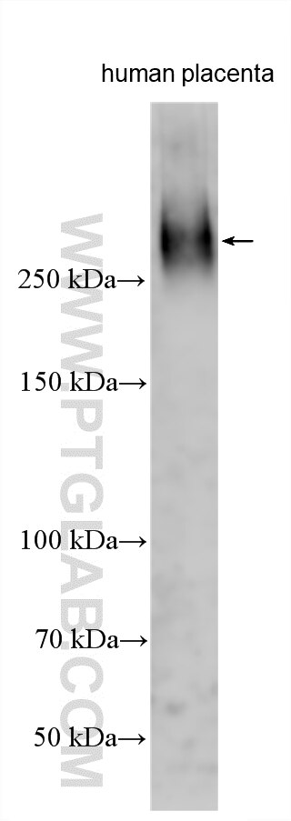 WB analysis using 31056-1-AP (same clone as 31056-1-PBS) Western Blot (WB) analysis of various lysates using Collagen Type XV Polyclonal antibody (31056-1-AP)