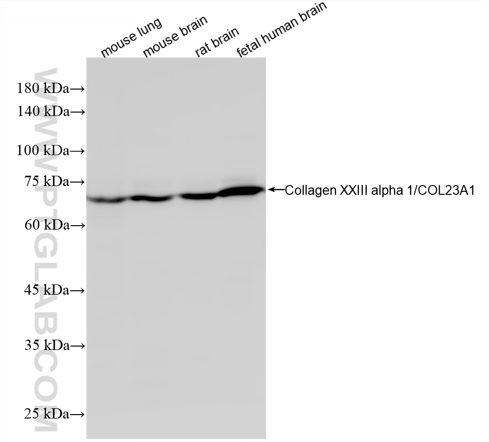 Western Blot (WB) analysis of various lysates using Collagen Type XXIII Recombinant monoclonal antibod (87687-3-RR)