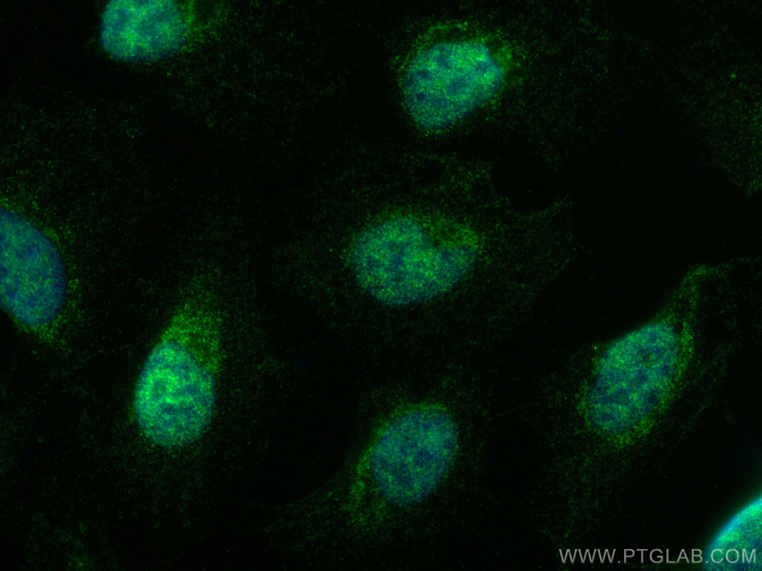 Immunofluorescence (IF) / fluorescent staining of U2OS cells using Collagen Type XXVIII Polyclonal antibody (24401-1-AP)