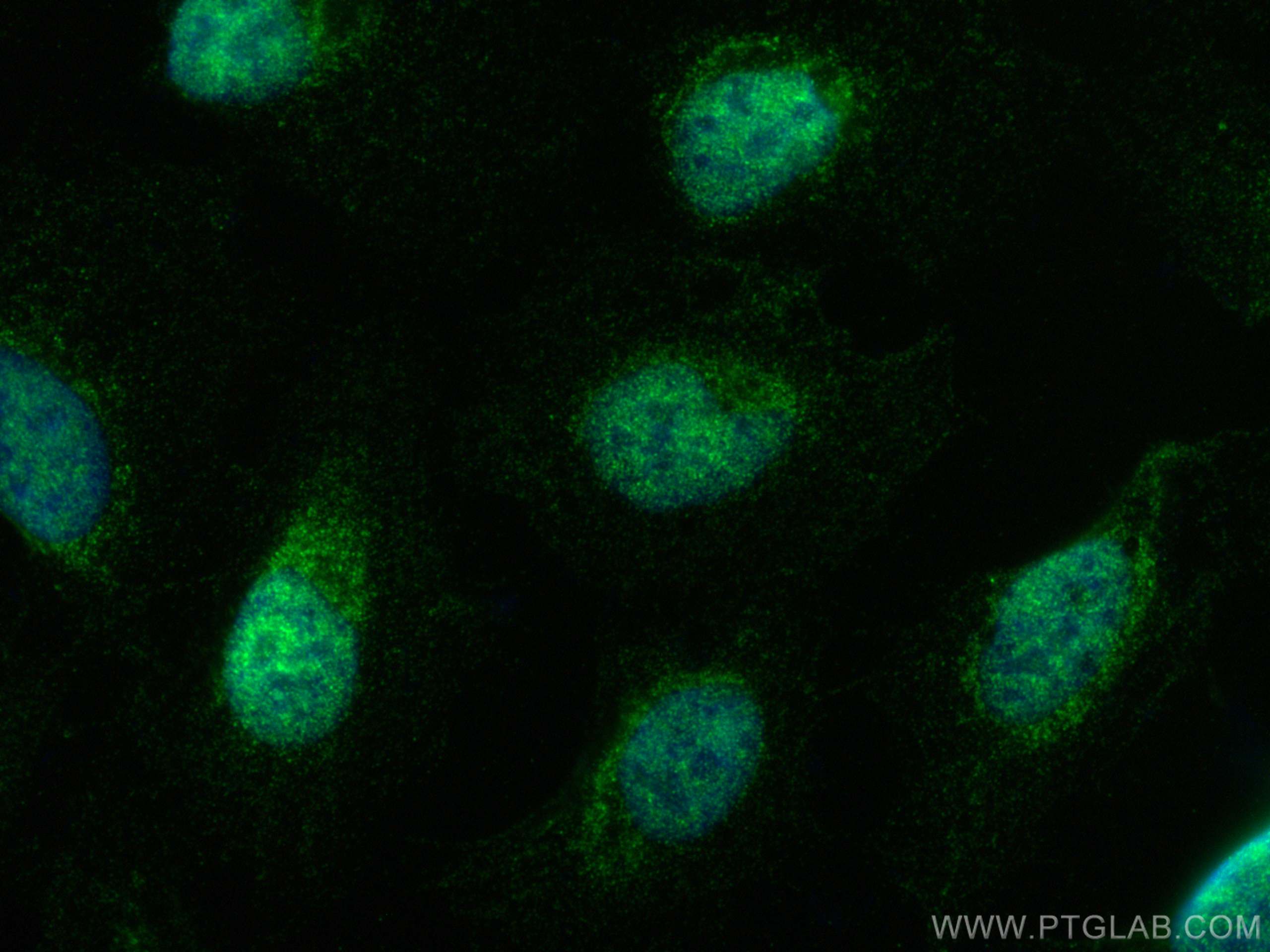 IF Staining of U2OS using 24401-1-AP