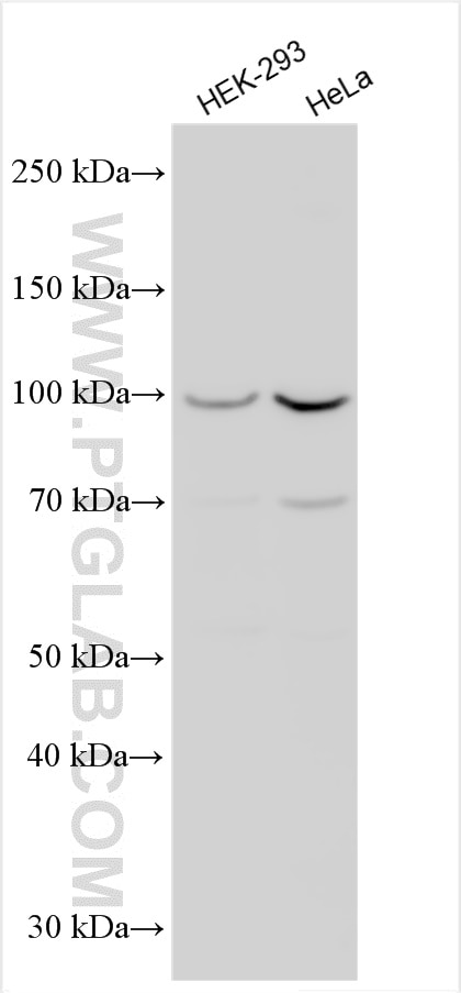 Western Blot (WB) analysis of various lysates using Collagen Type XXVIII Polyclonal antibody (24401-1-AP)