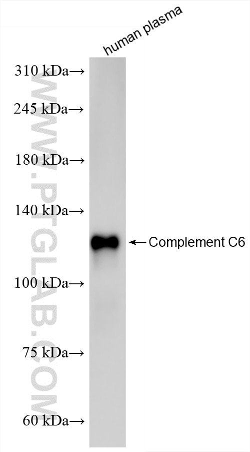 Western Blot (WB) analysis of human plasma using Complement C6 Recombinant antibody (86286-3-RR)