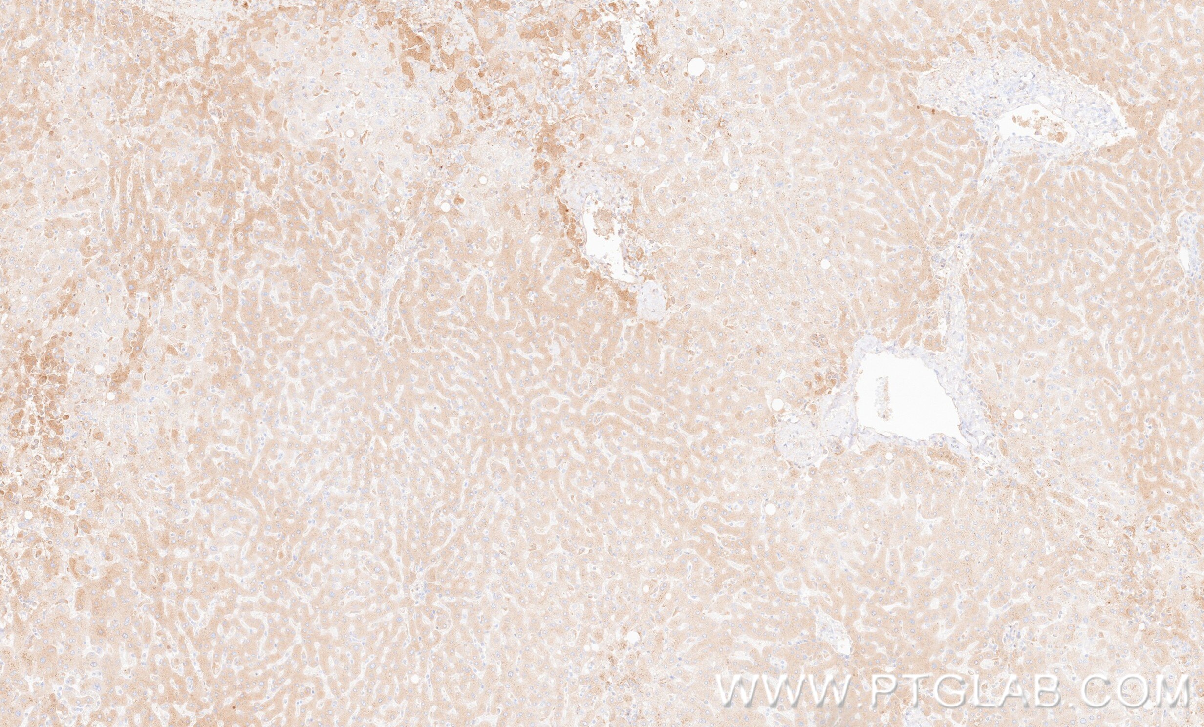 Immunohistochemistry (IHC) staining of human liver tissue using Complement Factor I Recombinant monoclonal antibod (87109-1-RR)