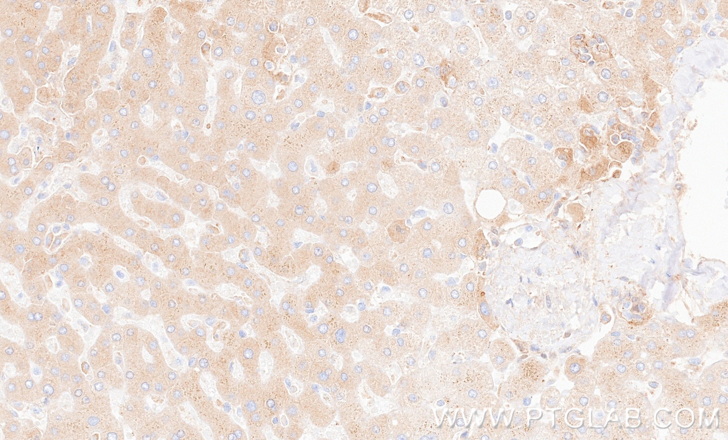Immunohistochemistry (IHC) staining of human liver tissue using Complement Factor I Recombinant monoclonal antibod (87109-1-RR)
