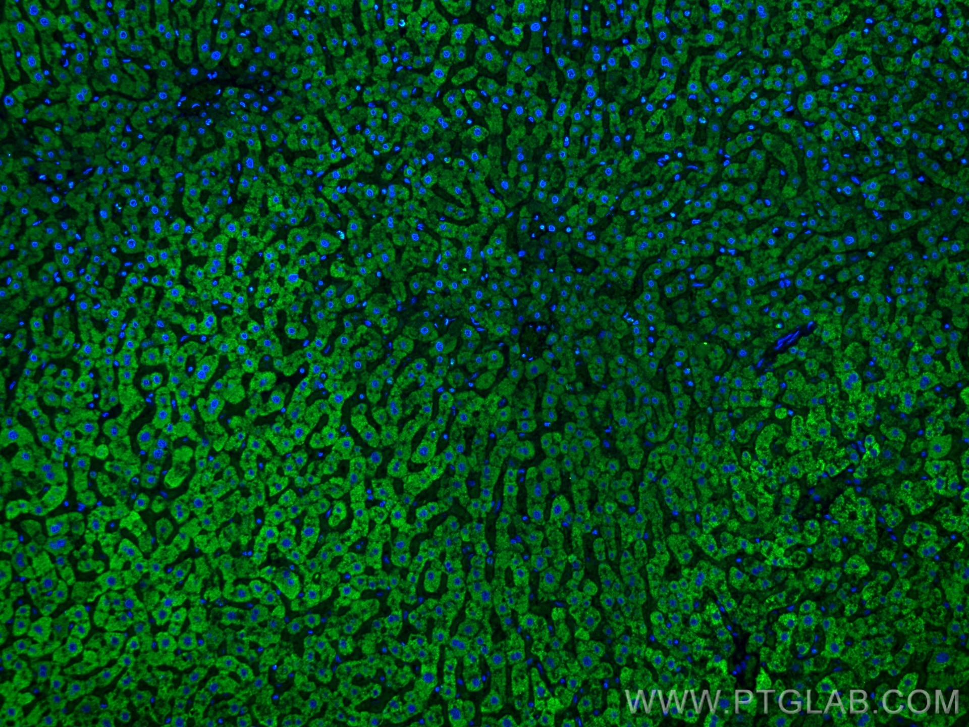 Immunofluorescence (IF) / fluorescent staining of human liver tissue using CoraLite® Plus 488-conjugated Complement factor B  (CL488-66154)