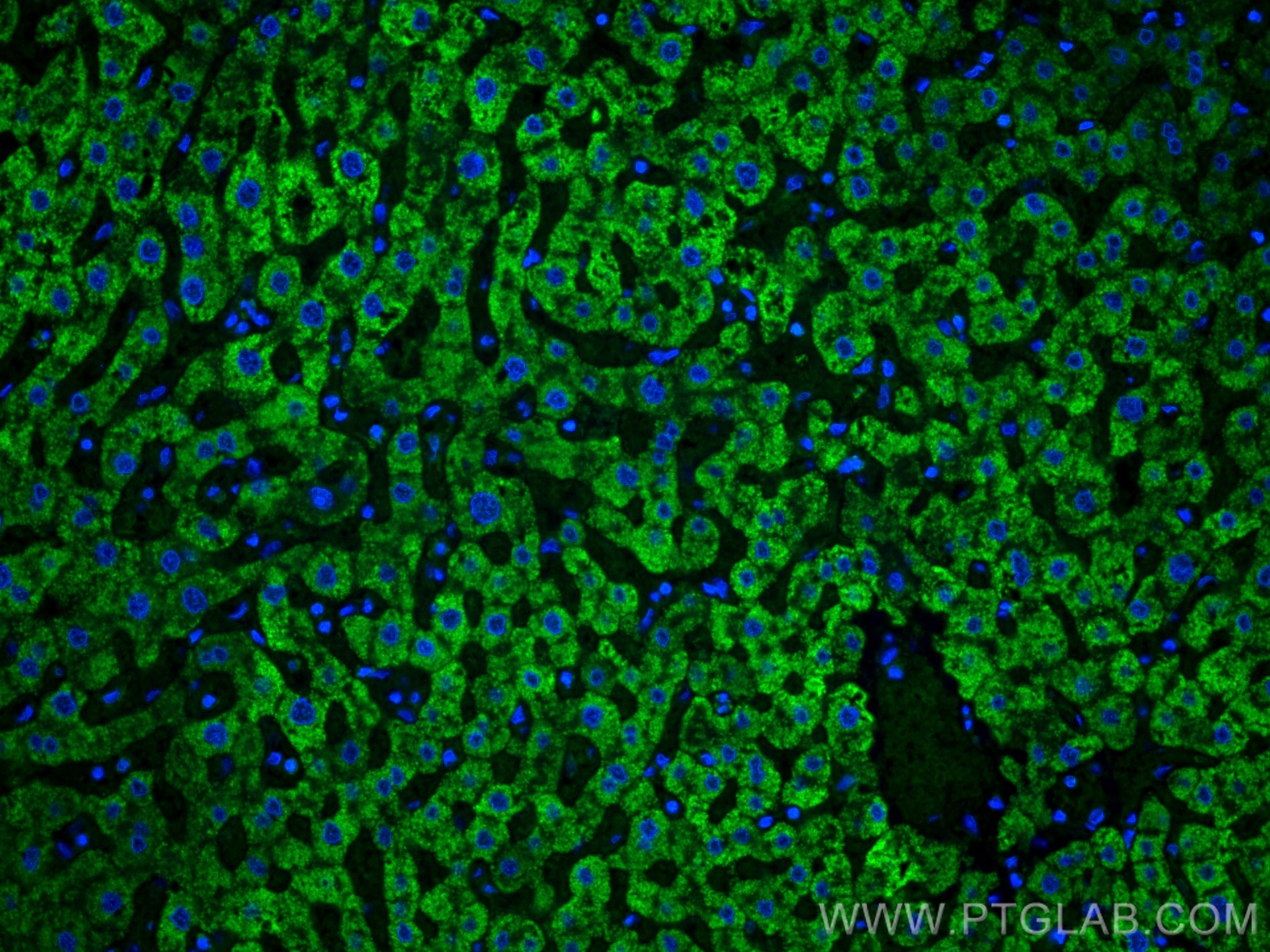 Immunofluorescence (IF) / fluorescent staining of human liver tissue using CoraLite® Plus 488-conjugated Complement factor B  (CL488-66154)