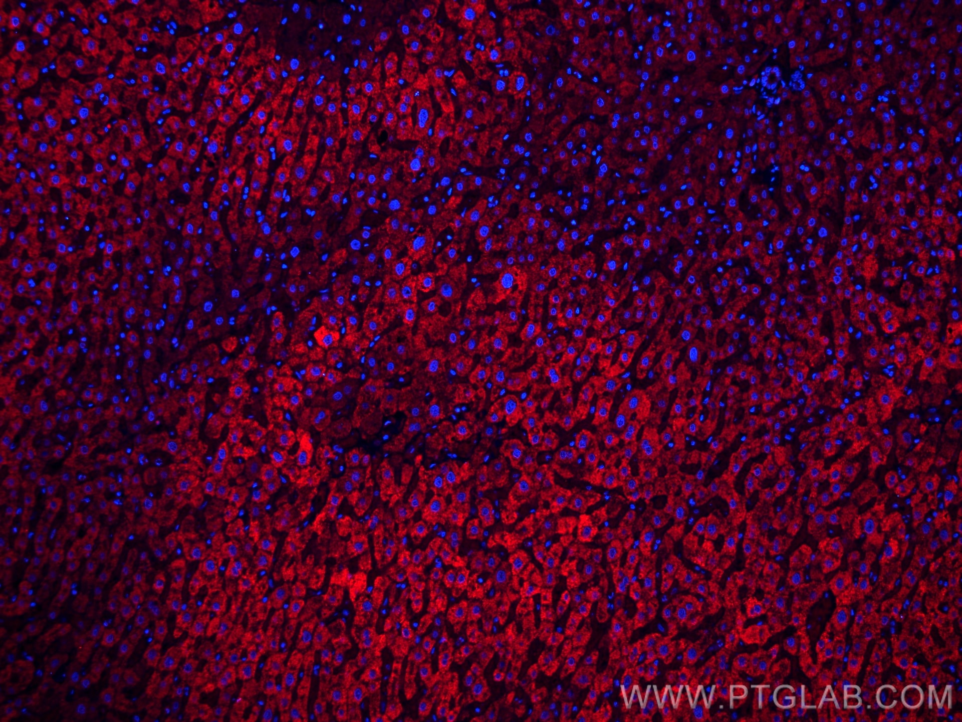 Immunofluorescence (IF) / fluorescent staining of human liver tissue using CoraLite®594-conjugated Complement factor B Monocl (CL594-66154)