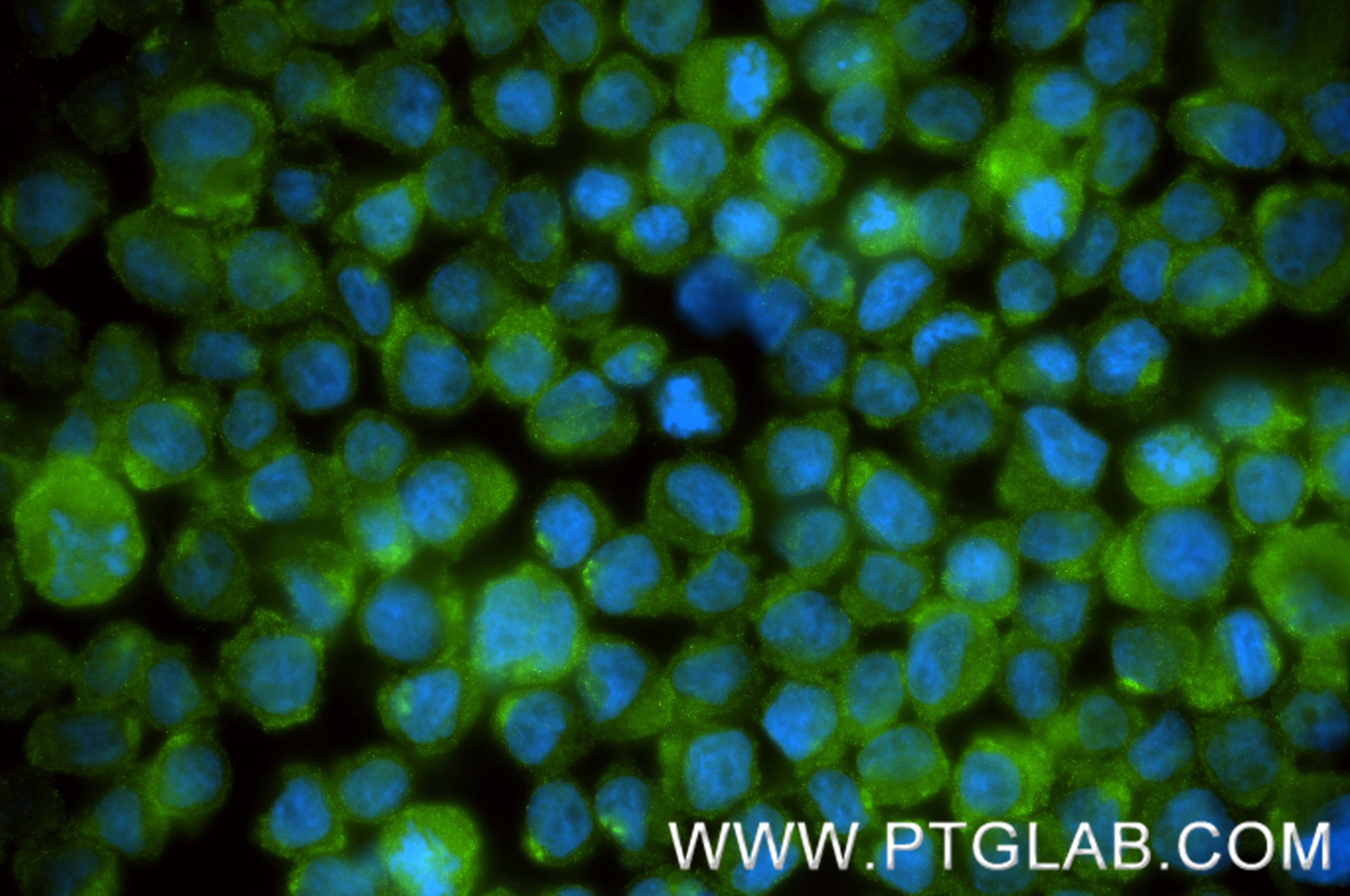 Immunofluorescent analysis of (4% PFA) fixed THP-1 cells using Complement factor D antibody (84851-4-RR, Clone: 242244C2 ) at dilution of 1:200 and CoraLite®488-Conjugated Goat Anti-Rabbit IgG(H+L) (SA00013-2). Immunofluorescence (IF) / fluorescent staining of THP-1 cells using Complement factor D Recombinant antibody (84851-4-RR)