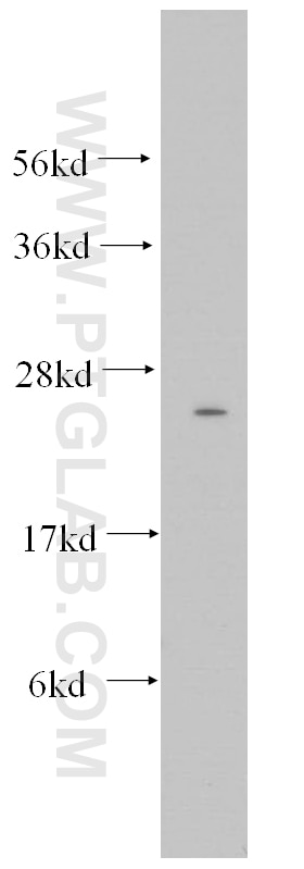 Western Blot (WB) analysis of human heart tissue using Connexin-26 Polyclonal antibody (14842-1-AP)