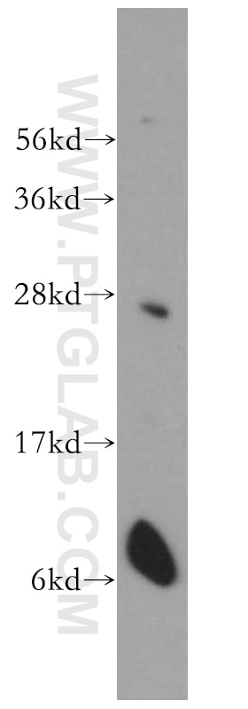 Western Blot (WB) analysis of mouse brain tissue using Connexin-26 Polyclonal antibody (14842-1-AP)