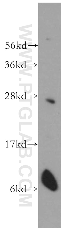 WB analysis of mouse brain using 14842-1-AP