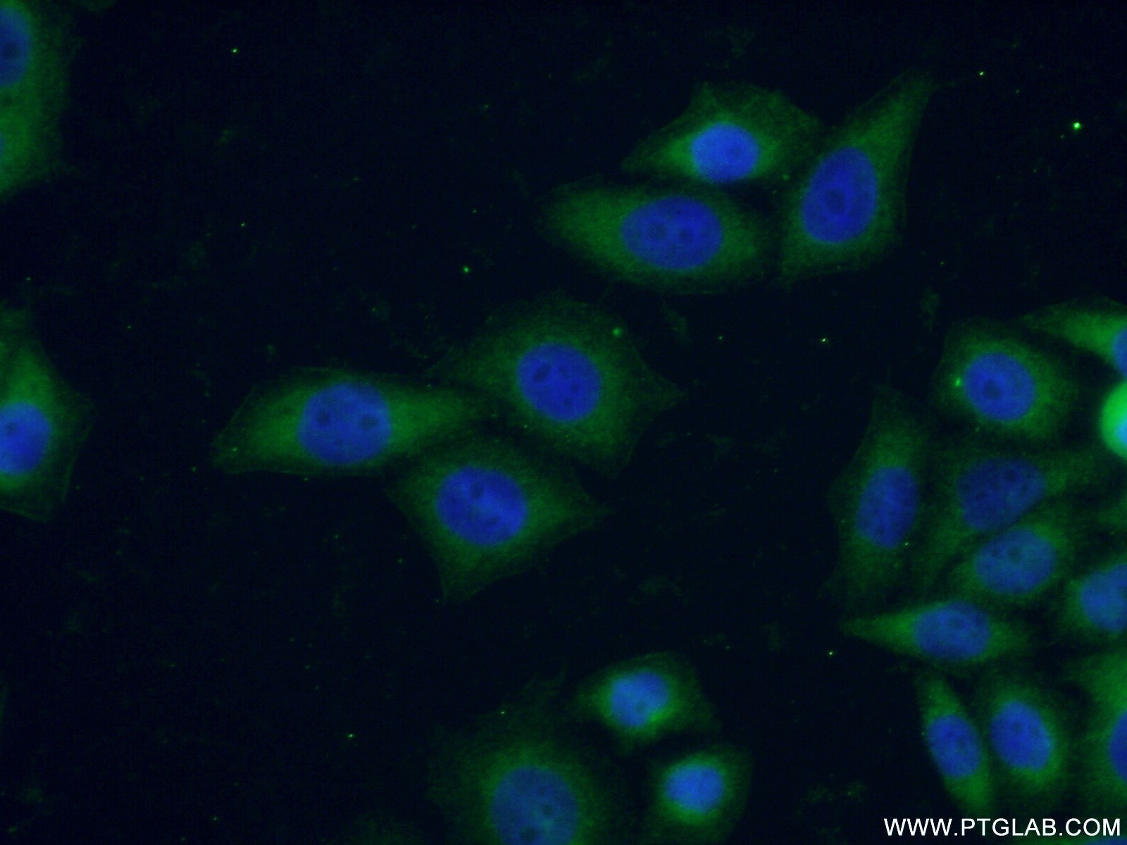 Immunofluorescence (IF) / fluorescent staining of PC-3 cells using Connexin-26 Polyclonal antibody (16960-1-AP)