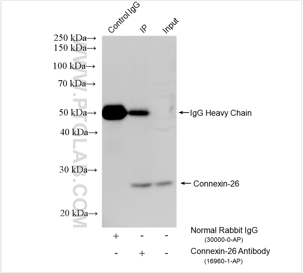 Immunoprecipitation (IP) experiment of PC-3 cells using Connexin-26 Polyclonal antibody (16960-1-AP)