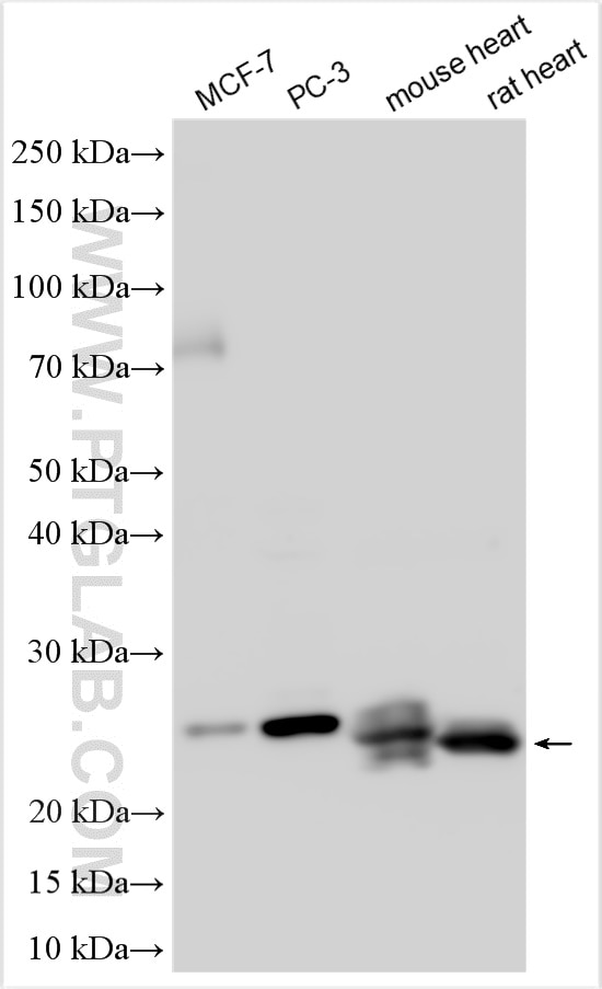 Western Blot (WB) analysis of various lysates using Connexin-26 Polyclonal antibody (16960-1-AP)