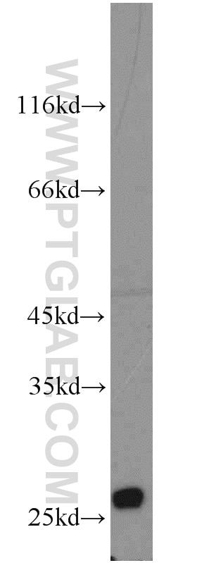 Connexin-26 Polyclonal antibody