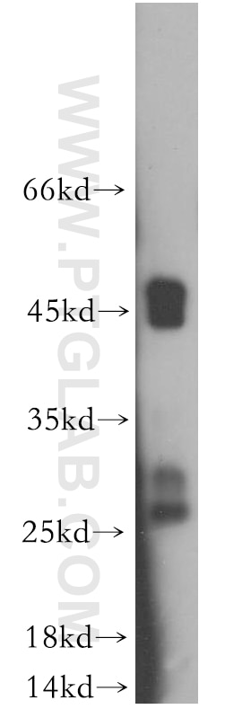 Western Blot (WB) analysis of human liver tissue using Connexin-26 Polyclonal antibody (16960-1-AP)