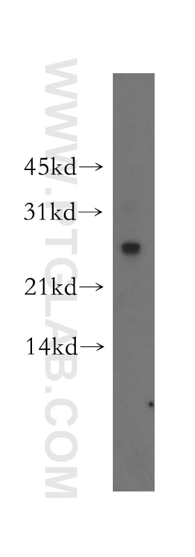 WB analysis of human brain using 51037-2-AP