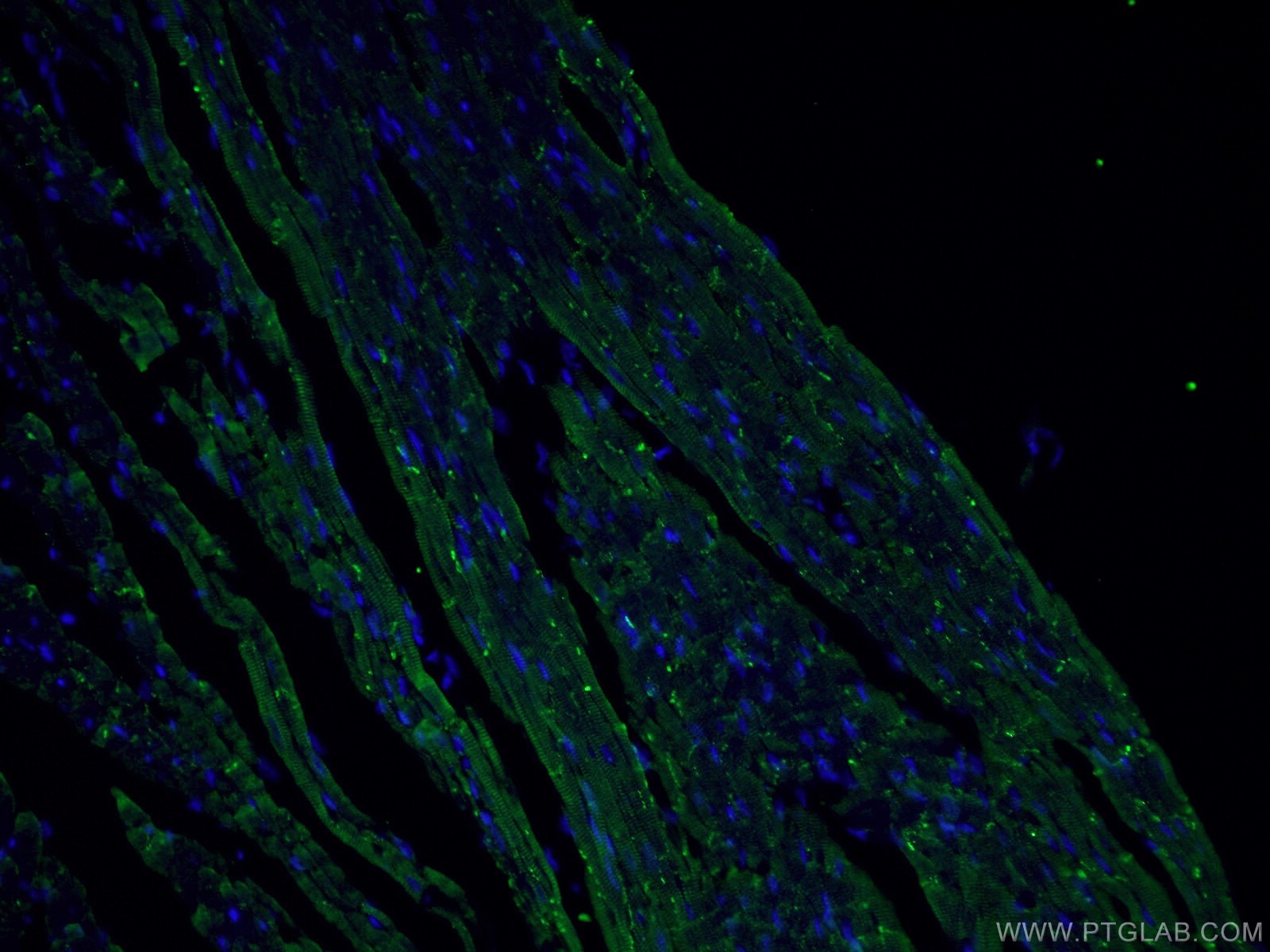 Immunofluorescence (IF) / fluorescent staining of human heart tissue using Connexin 43 Polyclonal antibody (26980-1-AP)