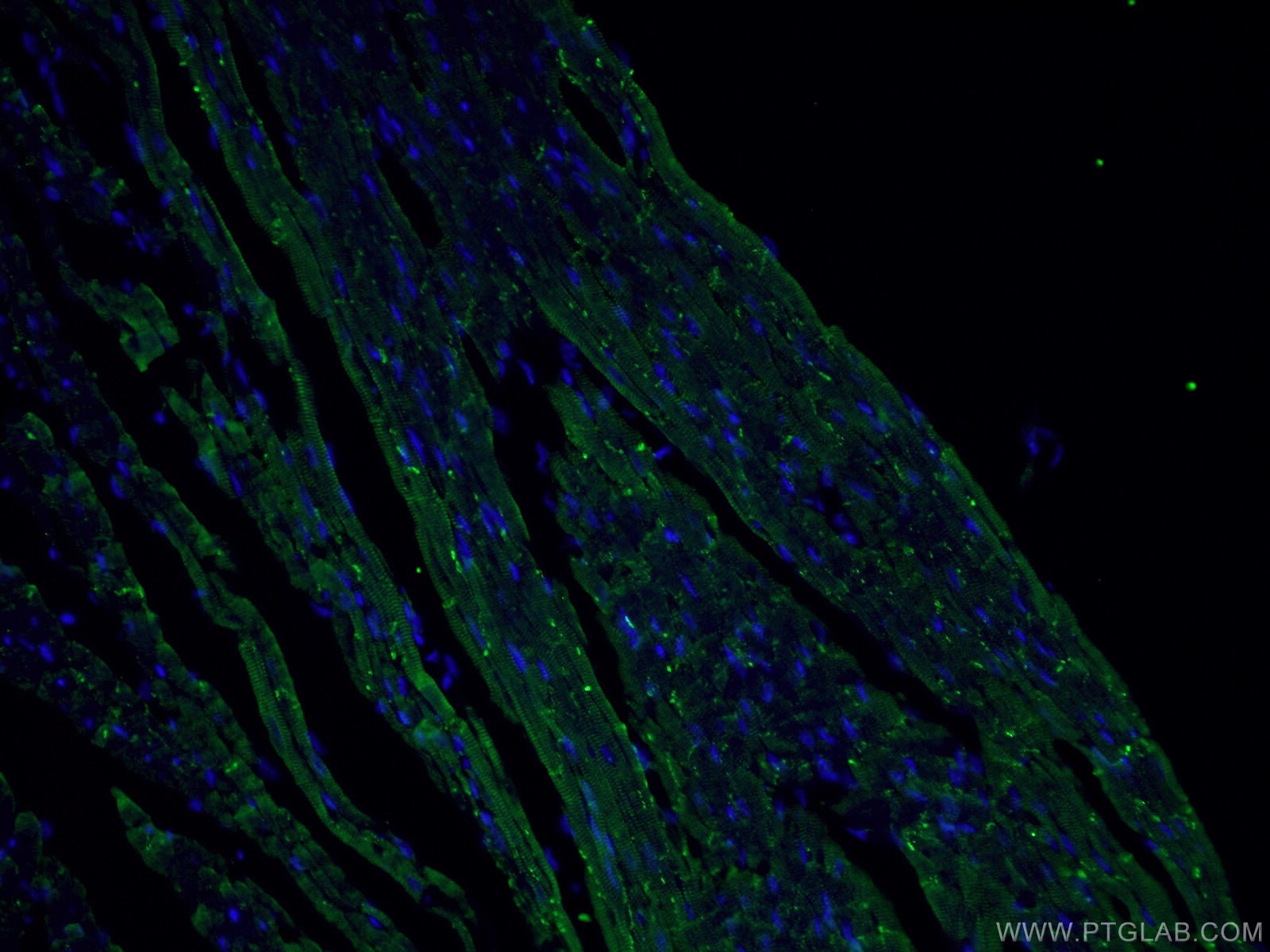 IF Staining of human heart using 26980-1-AP