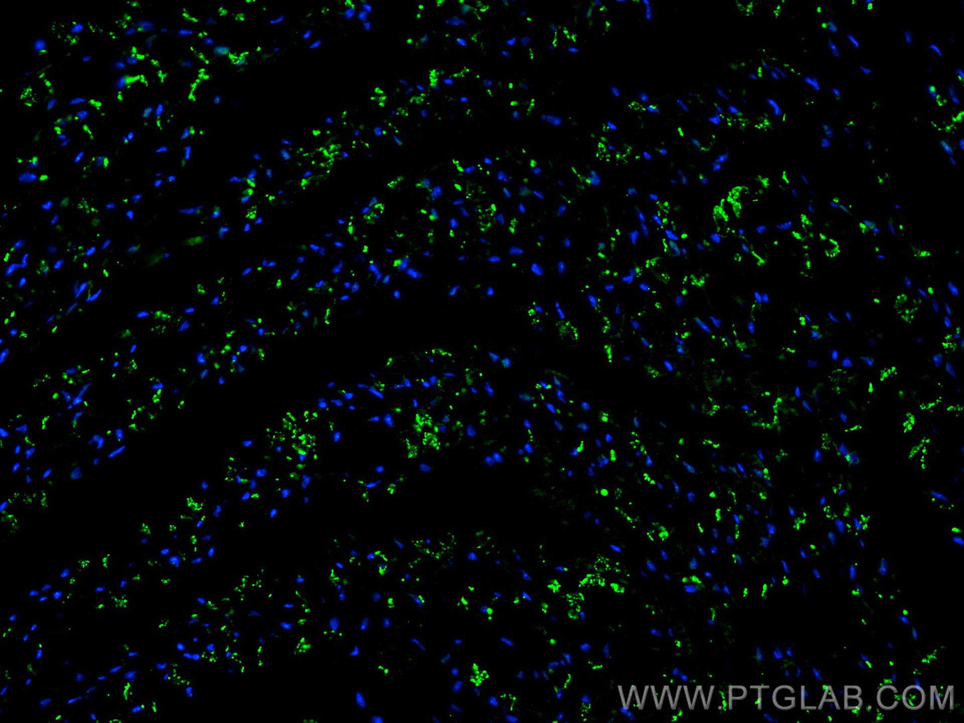 Immunofluorescence (IF) / fluorescent staining of mouse heart tissue using Connexin 43 Polyclonal antibody (26980-1-AP)