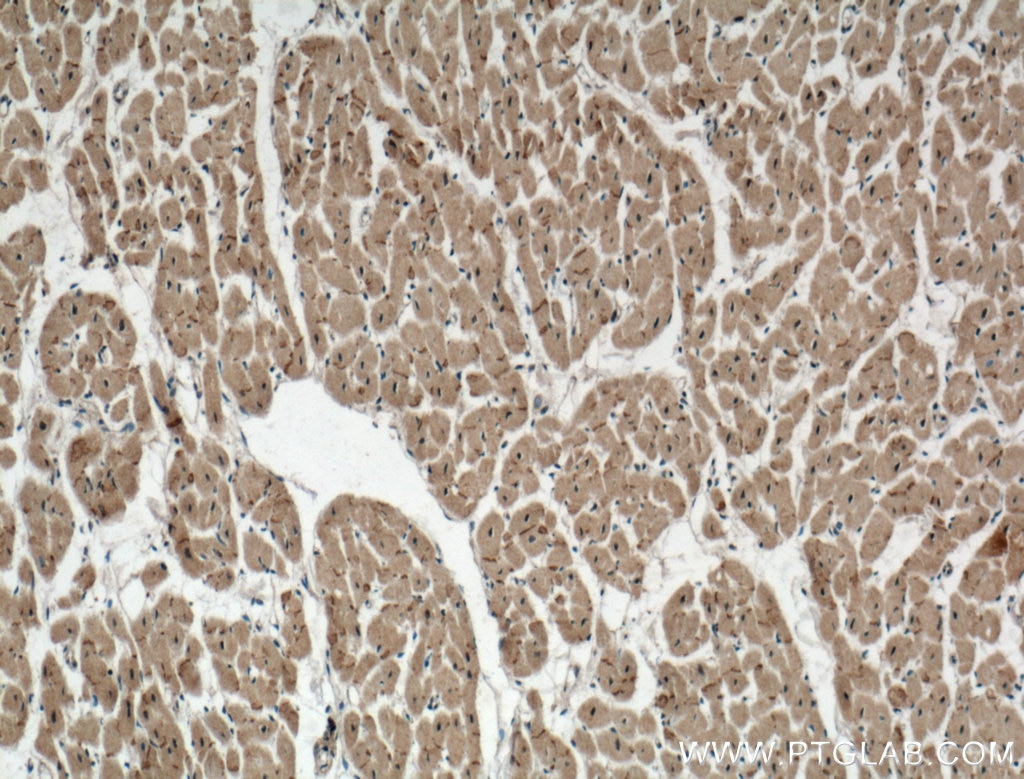 Immunohistochemistry (IHC) staining of human heart tissue using Connexin 43 Polyclonal antibody (26980-1-AP)