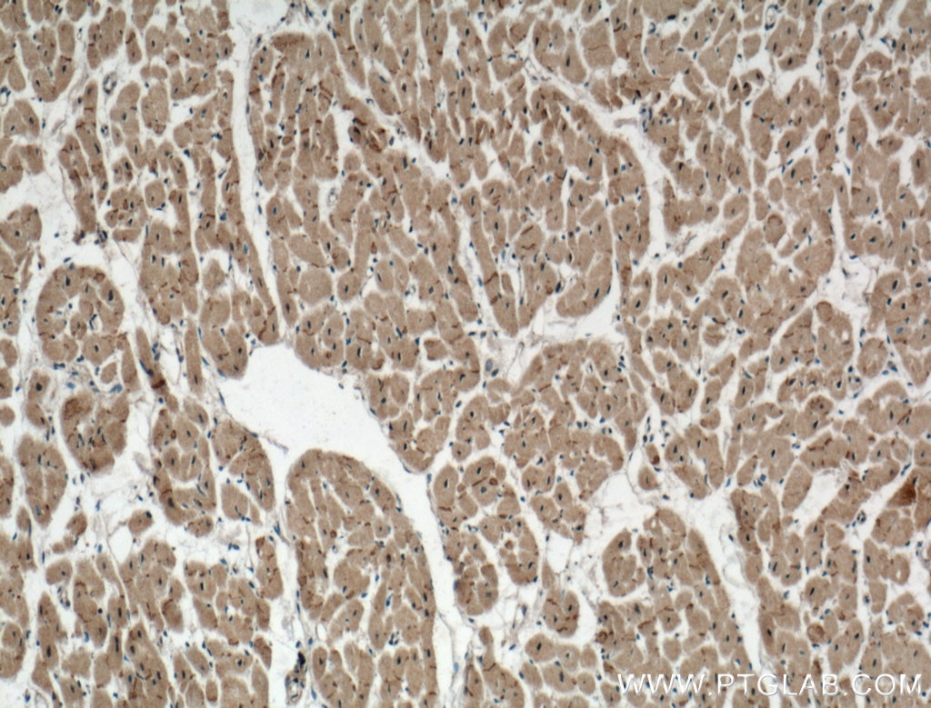 IHC staining of human heart using 26980-1-AP