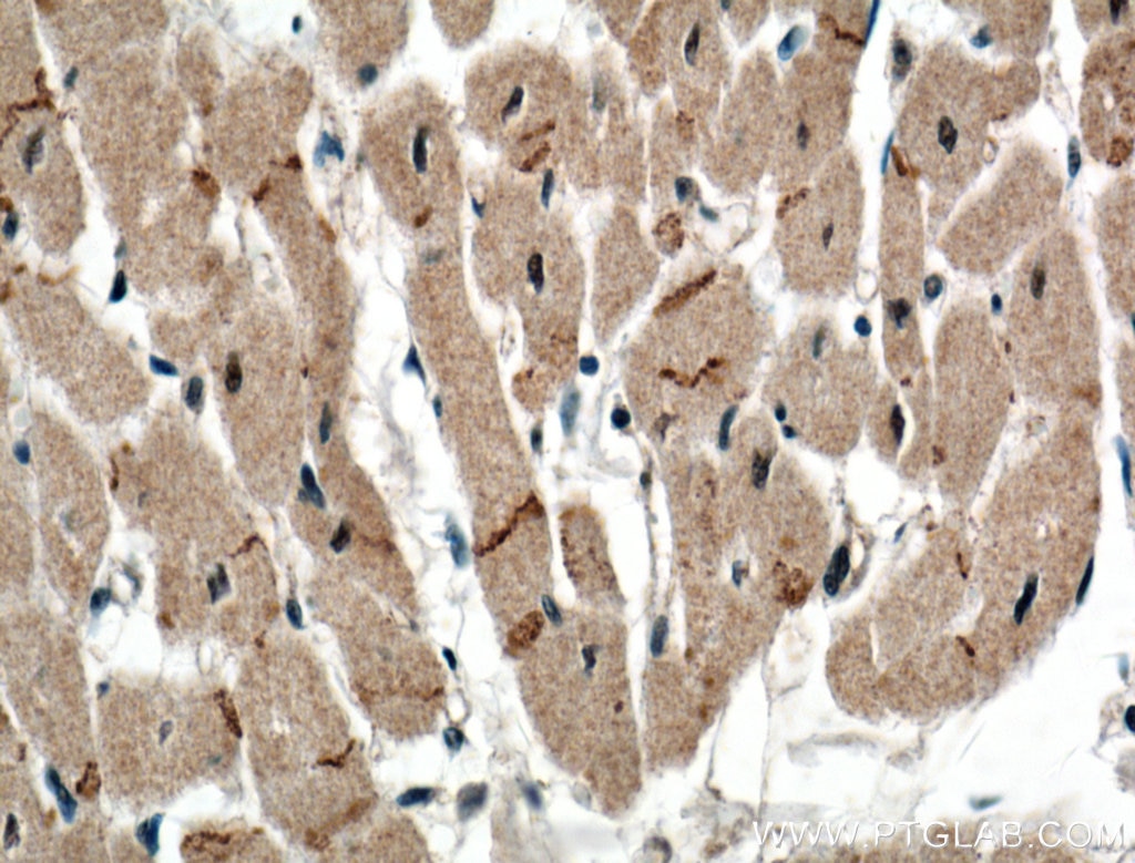 IHC staining of human heart using 26980-1-AP