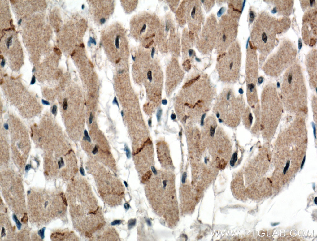 Immunohistochemistry (IHC) staining of human heart tissue using Connexin 43 Polyclonal antibody (26980-1-AP)