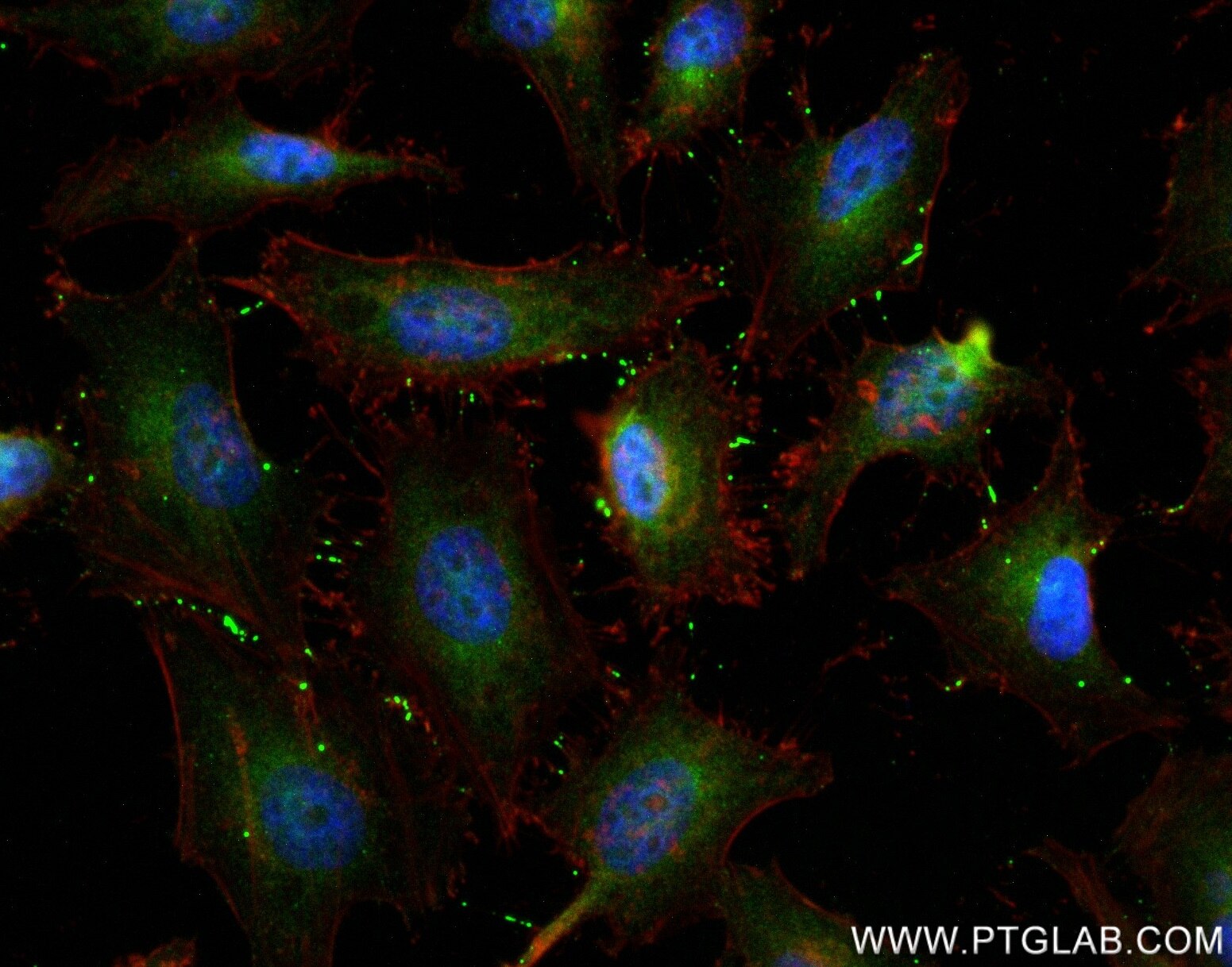 Immunofluorescence (IF) / fluorescent staining of HeLa cells using Connexin 43 Recombinant antibody (80543-1-RR)
