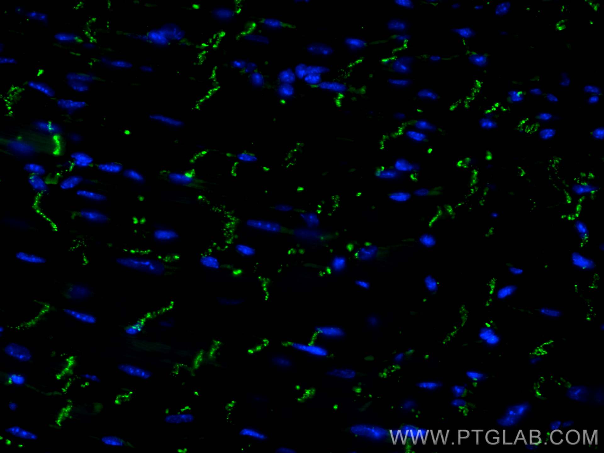 Immunofluorescence (IF) / fluorescent staining of mouse heart tissue using CoraLite® Plus 488-conjugated Connexin 43 Recombin (CL488-80543)