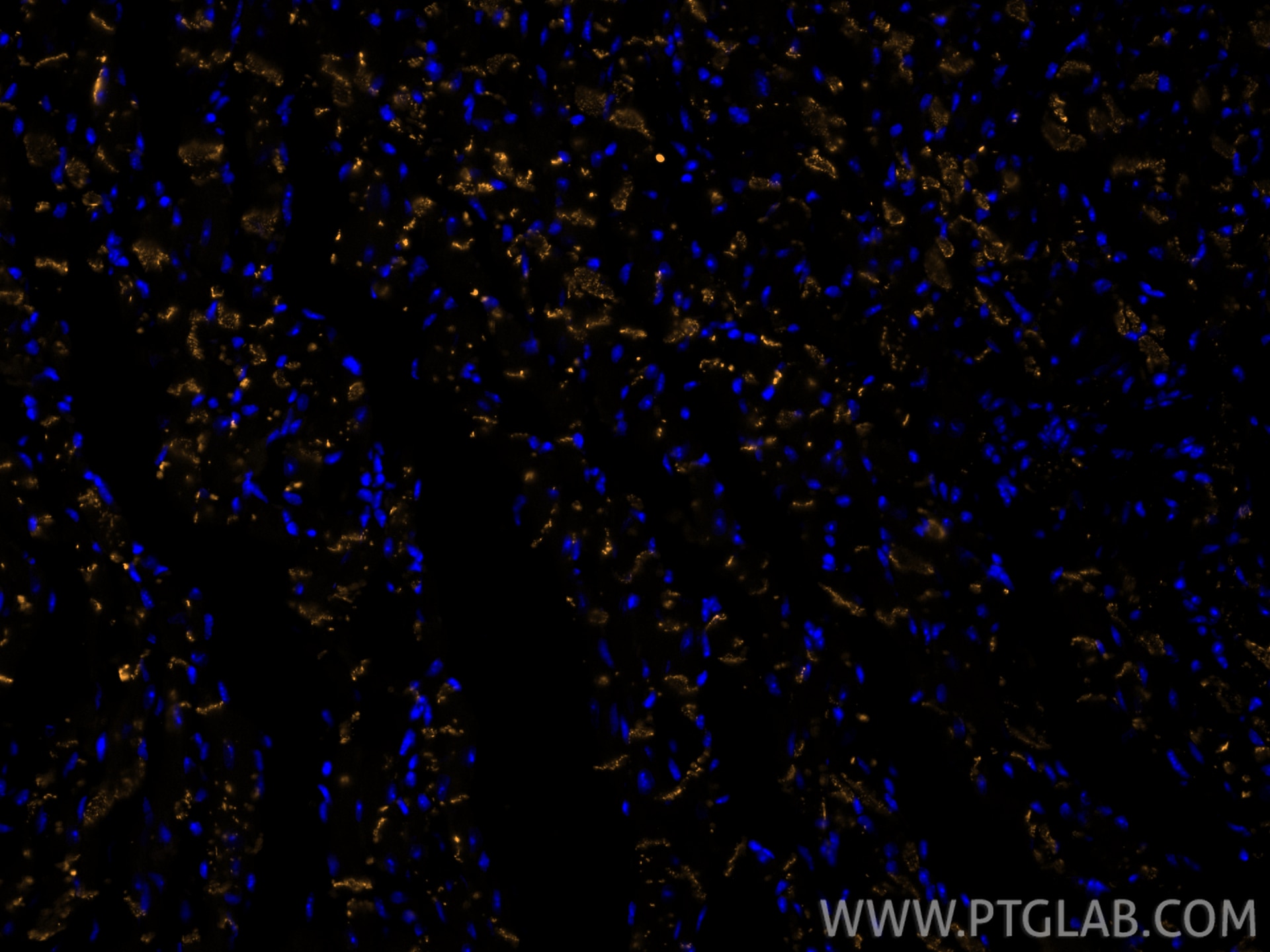 Immunofluorescence (IF) / fluorescent staining of mouse heart tissue using CoraLite® Plus 555-conjugated Connexin 43 Recombin (CL555-80543)