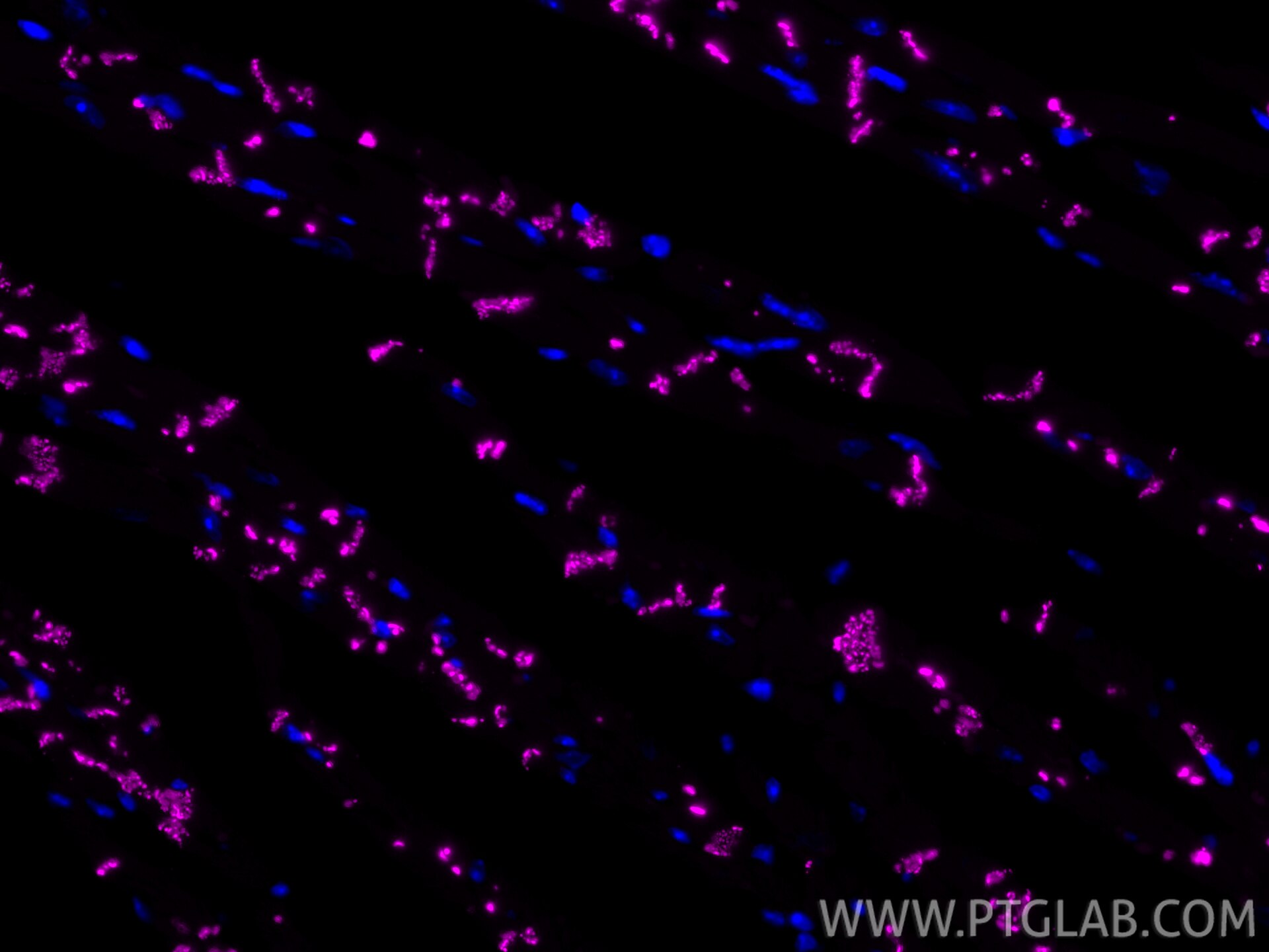 IF Staining of mouse heart using CL647-80543 Immunofluorescence (IF) / fluorescent staining of mouse heart tissue using CoraLite® Plus 647-conjugated Connexin 43 Recombin (CL647-80543)