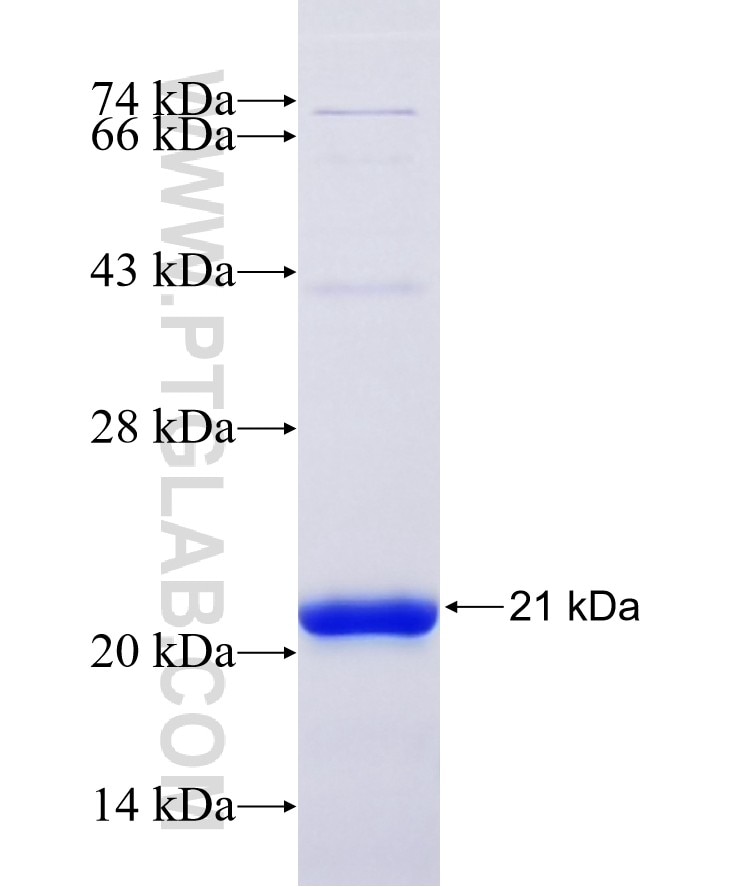 Connexin 43 fusion protein Ag27994 SDS-PAGE Connexin 43 fusion protein Ag27994 SDS-PAGE