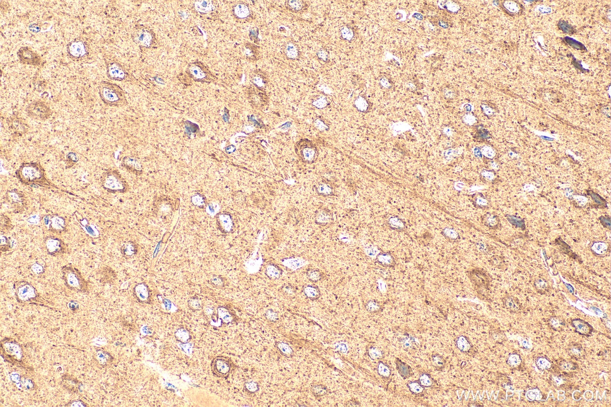 Immunohistochemistry (IHC) staining of mouse brain tissue using Connexin 45 Polyclonal antibody (22184-1-AP)