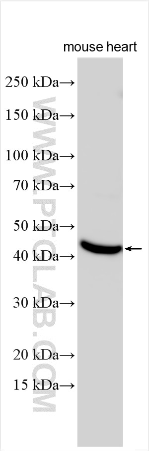 Western Blot (WB) analysis of various lysates using Connexin 45 Polyclonal antibody (22184-1-AP)