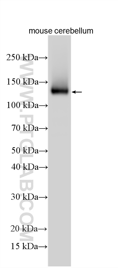 Western Blot (WB) analysis of various lysates using Contactin-6 Polyclonal antibody (33731-1-AP)