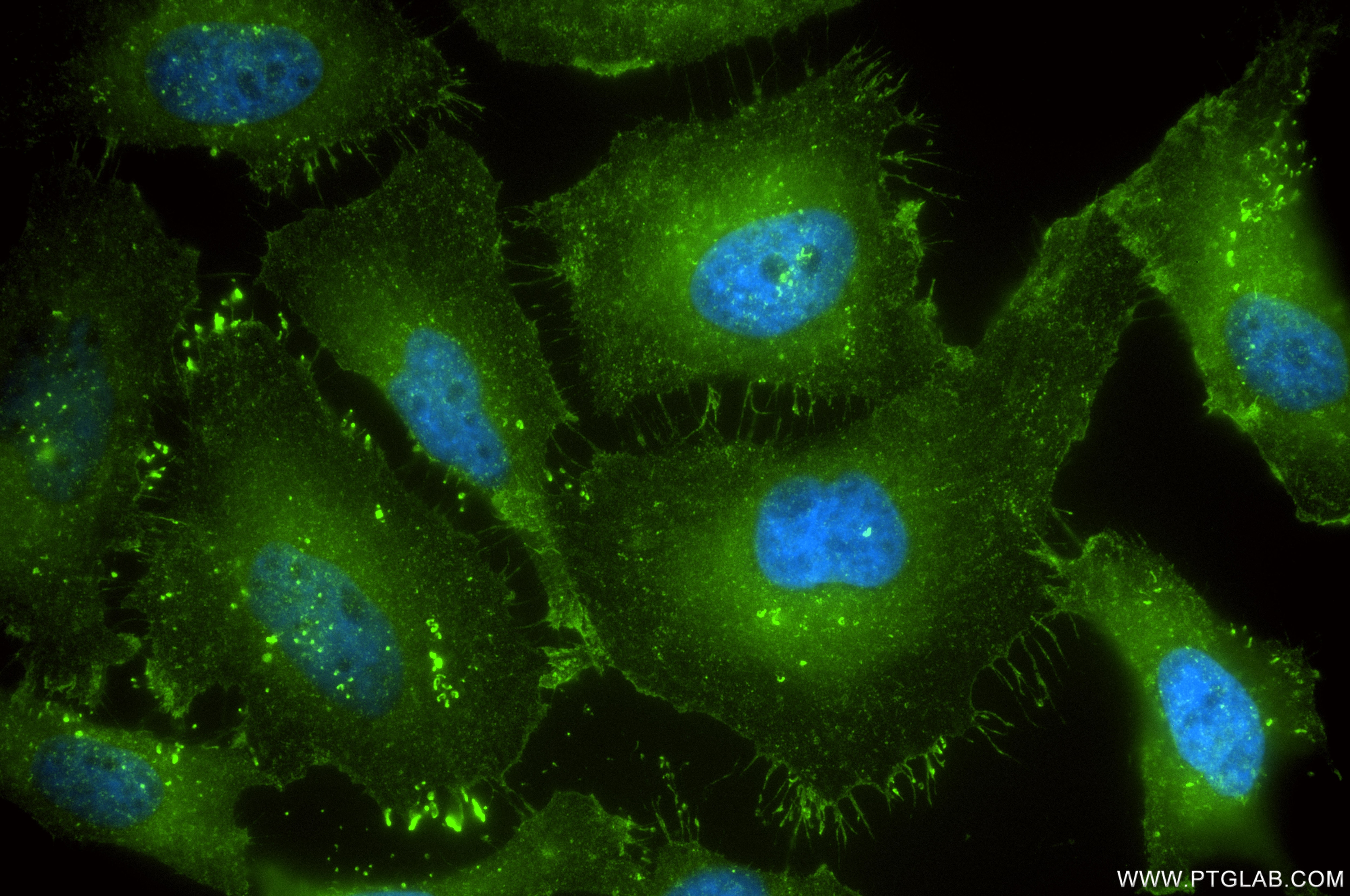 Immunofluorescent analysis of (4% PFA) fixed HeLa cells using Cortactin antibody (84569-1-RR, Clone: 241987A12 ) at dilution of 1:400 and CoraLite®488-Conjugated Goat Anti-Rabbit IgG(H+L) (SA00013-2). This data was developed using the same antibody clone with 84569-1-PBS in a different storage buffer formulation. Immunofluorescence (IF) / fluorescent staining of HeLa cells using Cortactin Recombinant monoclonal antibody (84569-1-RR)