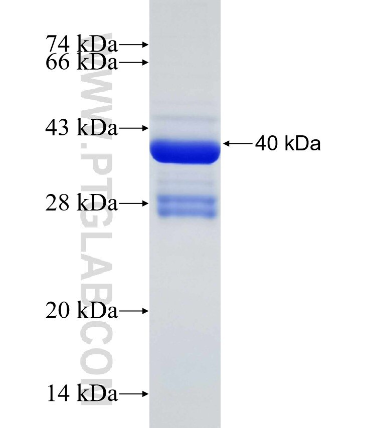 Corticosteroid binding globulin fusion protein Ag31861 SDS-PAGE