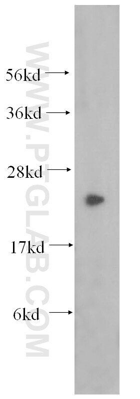 Western Blot (WB) analysis of mouse brain tissue using Crip2 Polyclonal antibody (51102-1-AP)