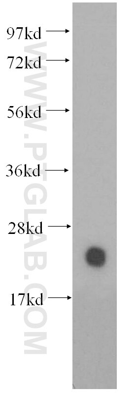 Western Blot (WB) analysis of mouse spleen tissue using Crip2 Polyclonal antibody (51102-1-AP)