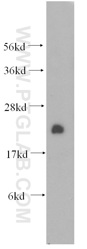 Western Blot (WB) analysis of mouse brain tissue using Crip2 Polyclonal antibody (51102-1-AP)