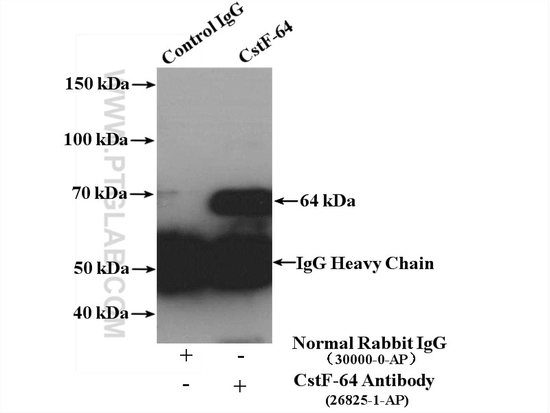 Immunoprecipitation (IP) experiment of HeLa cells using CstF-64 Polyclonal antibody (26825-1-AP)