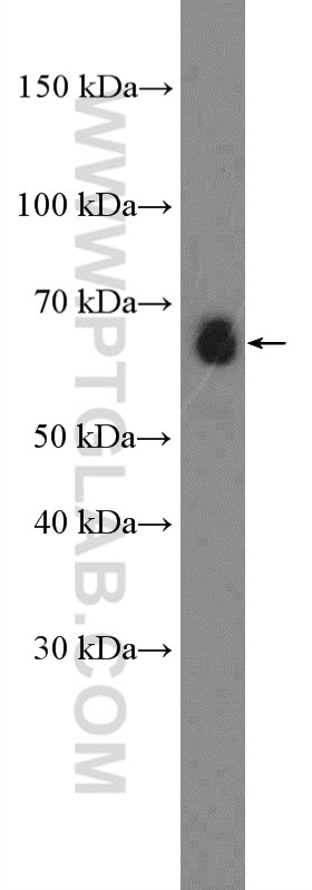 Western Blot (WB) analysis of COLO 320 cells using CstF-64 Polyclonal antibody (26825-1-AP)